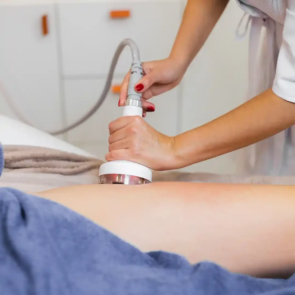 Cellulite Removal Treatments